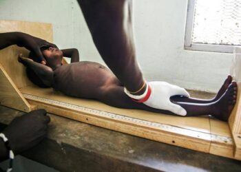 Banco Mundial diz ser quase impossível acabar com desnutrição infantil até 2030