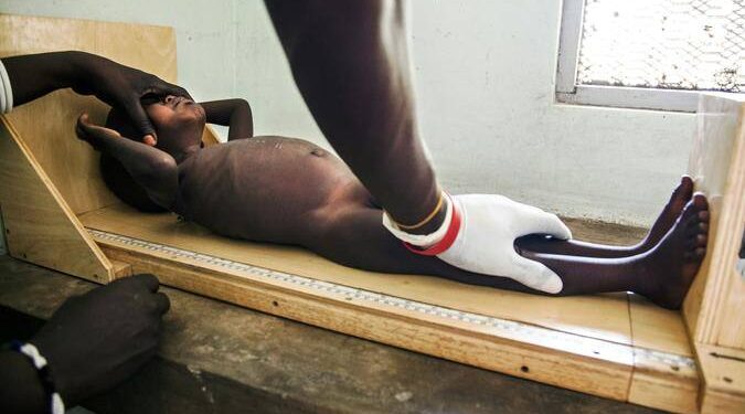 Banco Mundial diz ser quase impossível acabar com desnutrição infantil até 2030